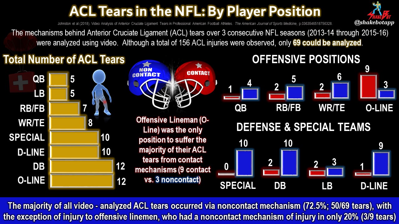 Read more about the article Anterior Cruciate Ligament (ACL) Tears in the NFL: The Majority are Not Caused By Contact